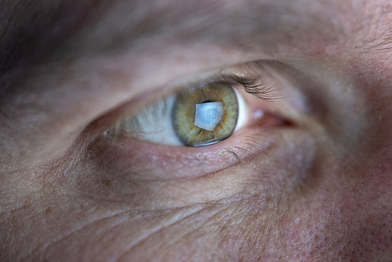 Auge in Nahaufnahme, in dem sich ein Computerbildschirm spiegelt